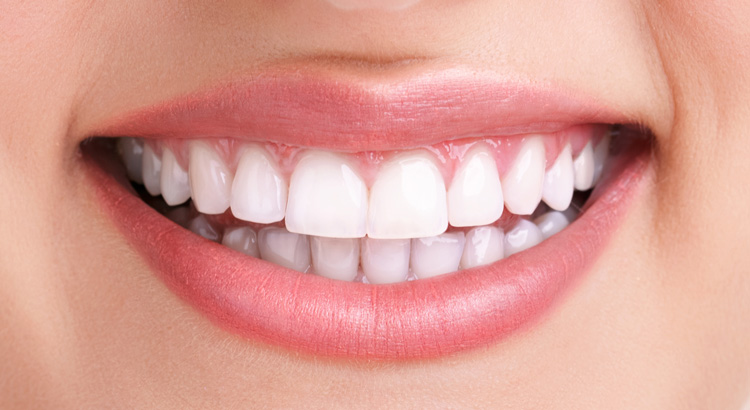 5 Essential Tips for Maintaining Healthy Teeth