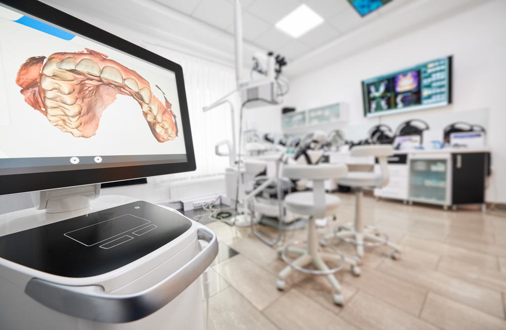 Digital Intraoral Scan