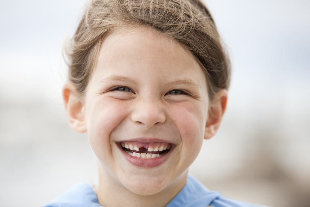 What Happens If You Don’t Replace a Missing Tooth?